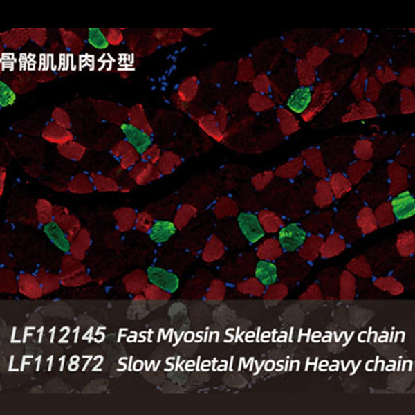 TSA熒光雙重染色試劑盒 100T （ABC1253）