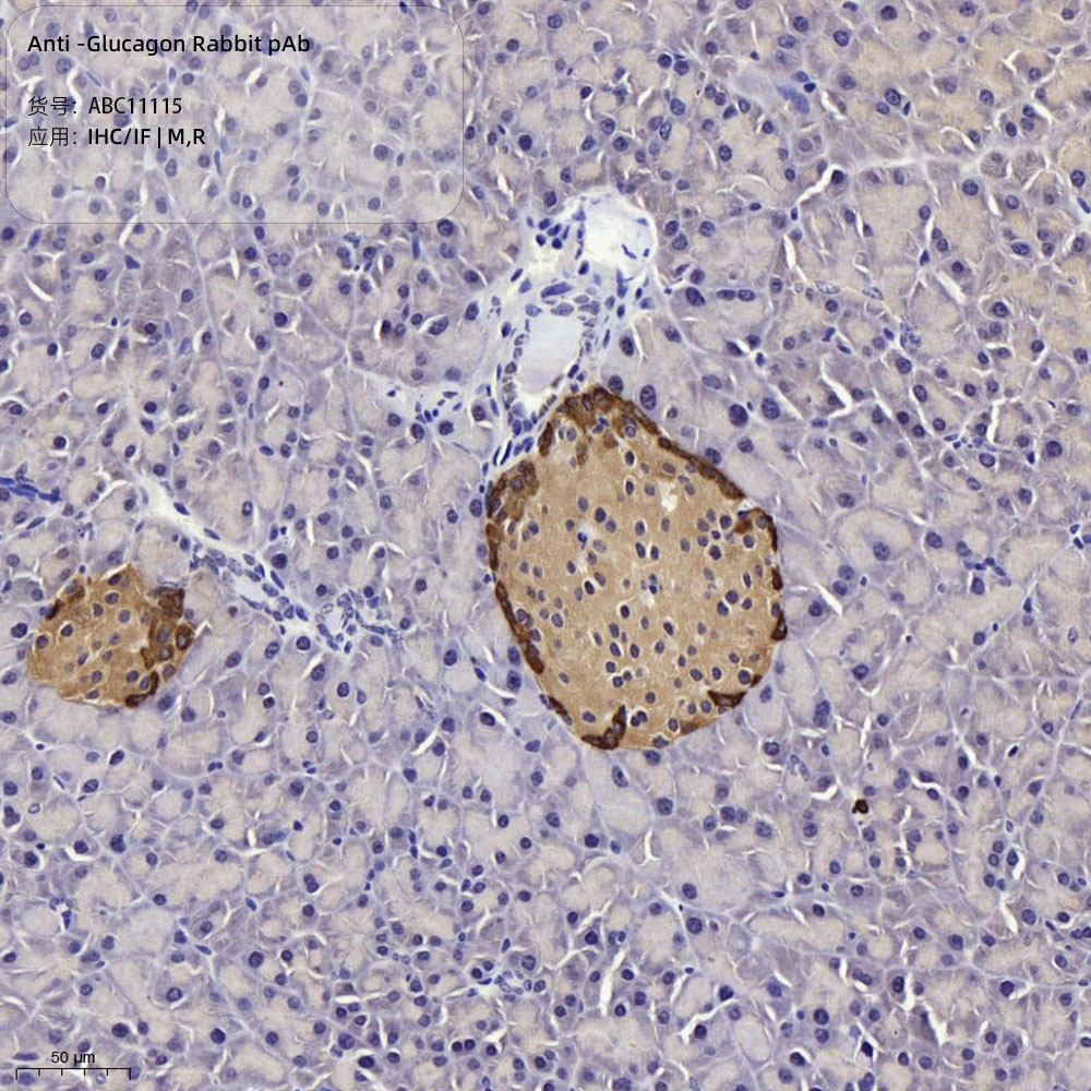 Anti -Glucagon Rabbit pAb （ABC11115）