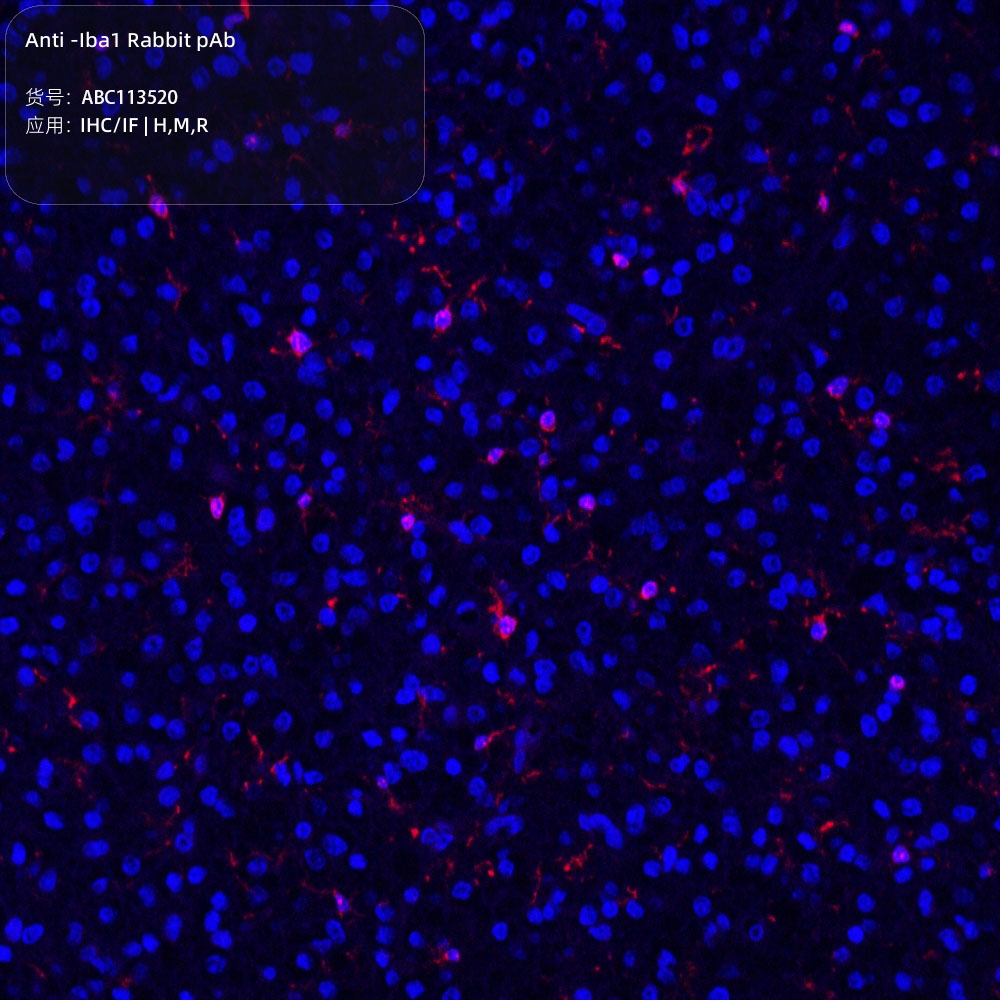 Anti -Iba1 Rabbit pAb （ABC113520）