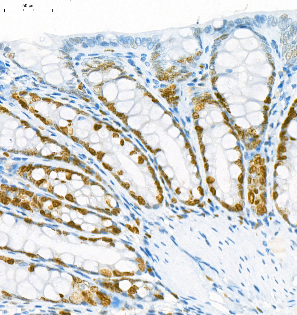 Anti -Ki67 Mouse mAb （ABC121159）