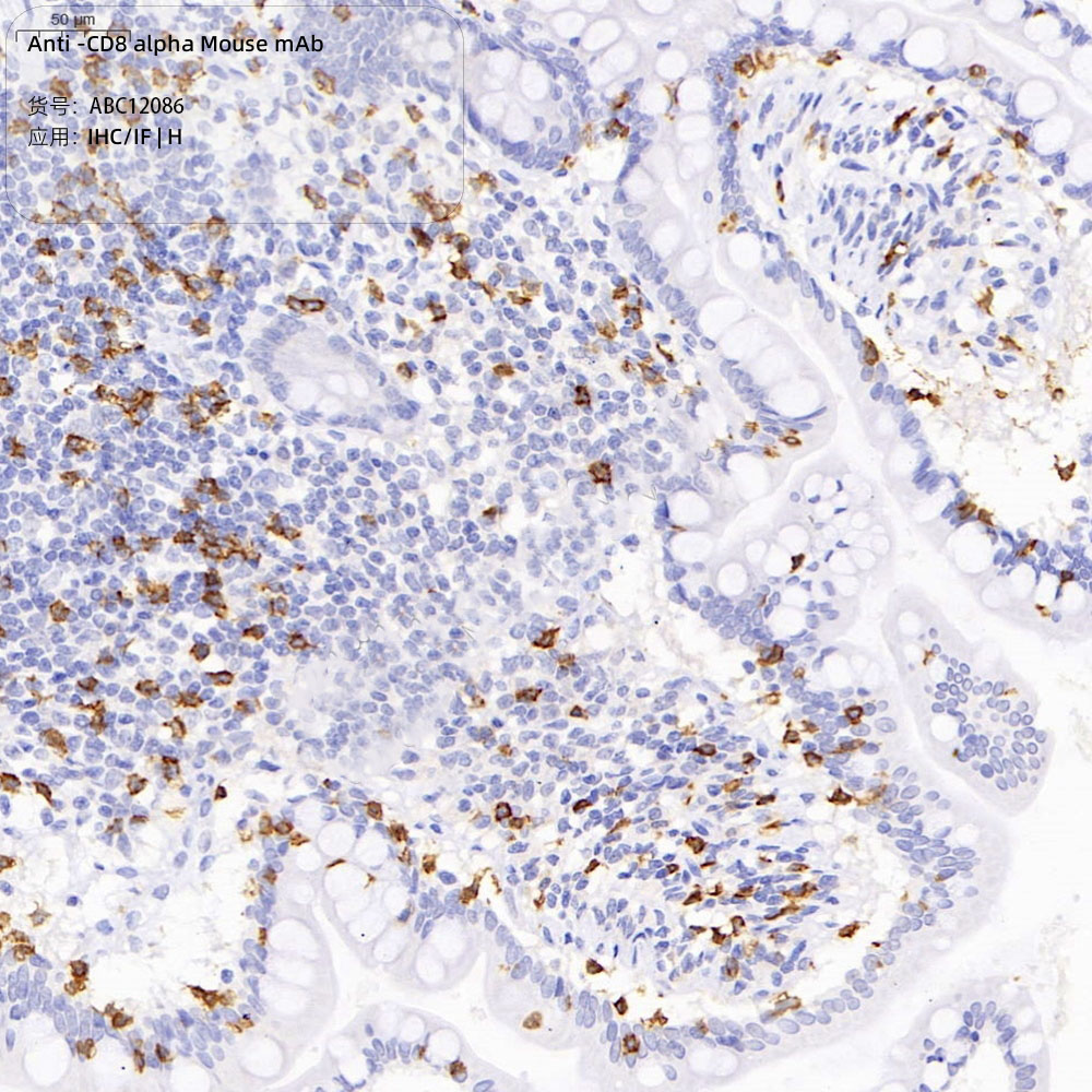 Anti -CD8 alpha Mouse mAb （ABC12086）