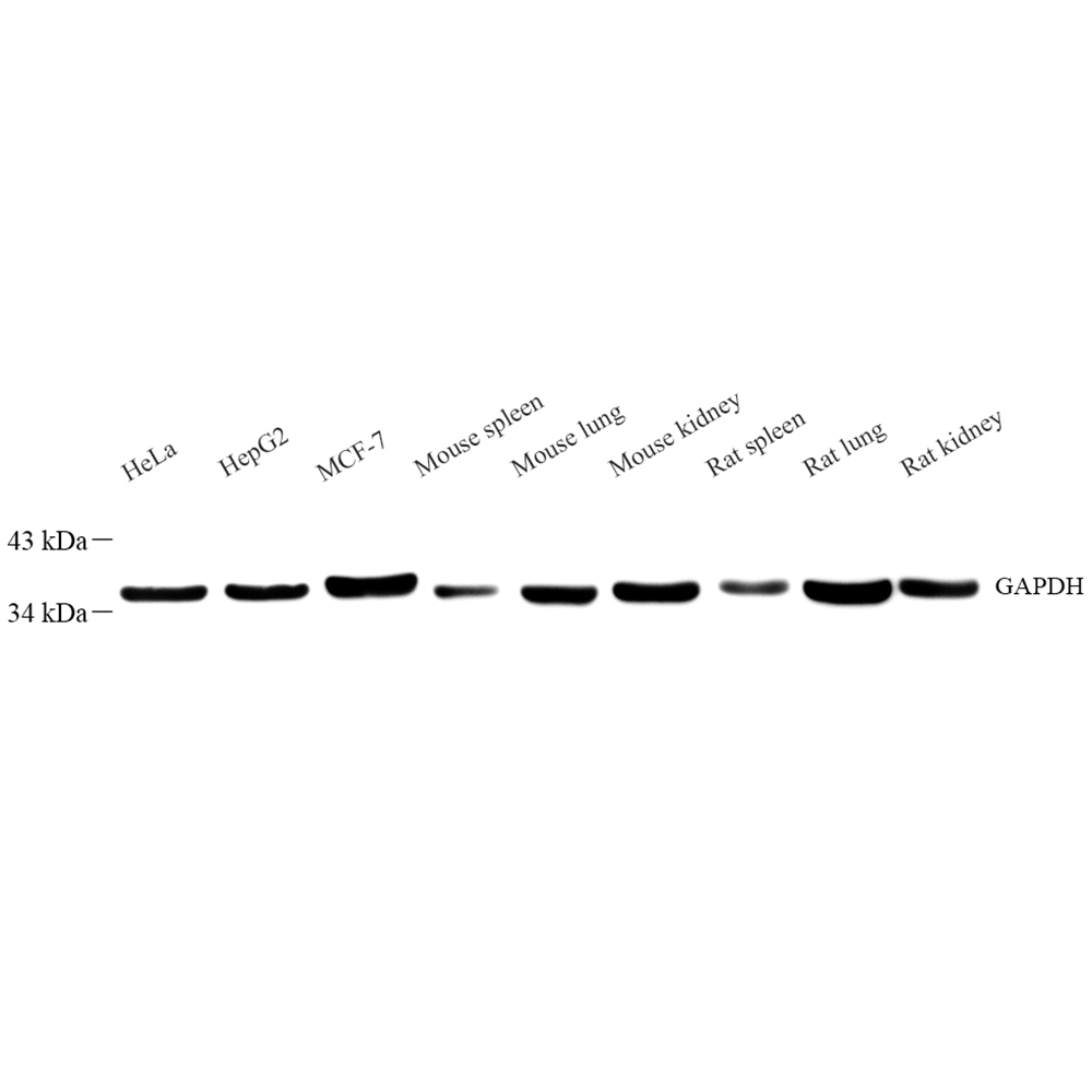 Anti -GAPDH Mouse mAb （ABC12020）