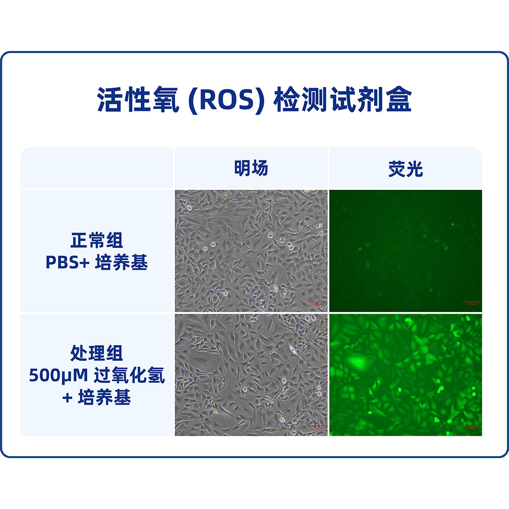 活性氧(ROS)檢測試劑盒 （ABC1724）
