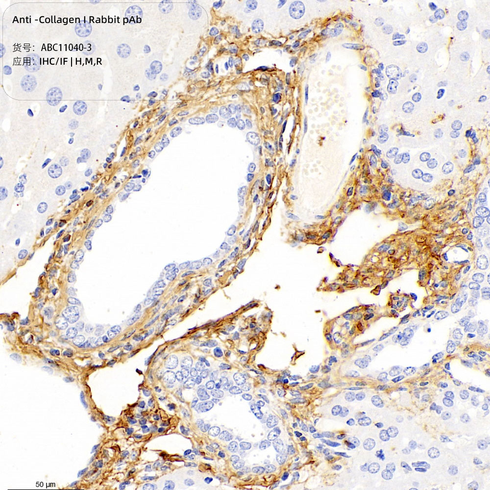 Anti -Collagen I Rabbit pAb （ABC11040-3）