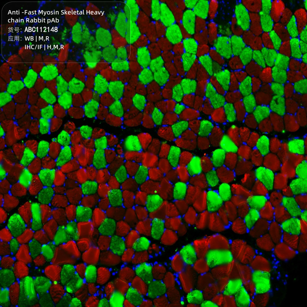 Anti -Fast Myosin Skeletal Heavy chain Rabbit pAb （ABC112148）