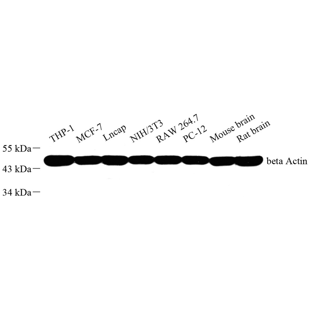 Anti -beta Actin Mouse mAb （ABC12019）