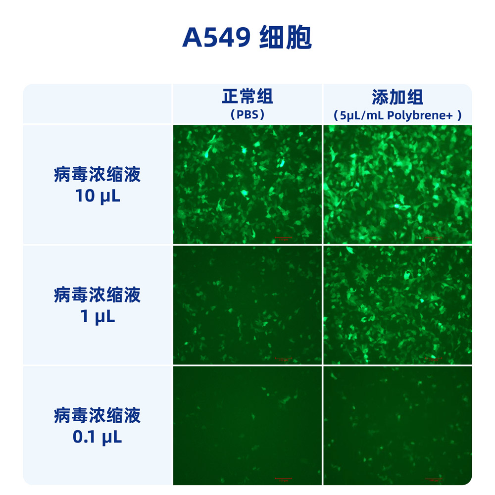 聚凝胺（10mg/ml） （ABC1821）