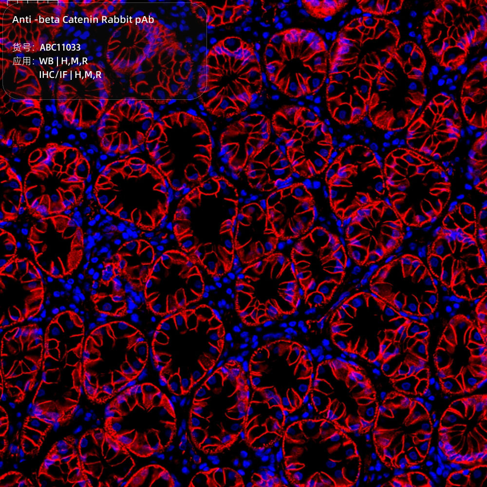 Anti -beta Catenin Rabbit pAb （ABC11033）