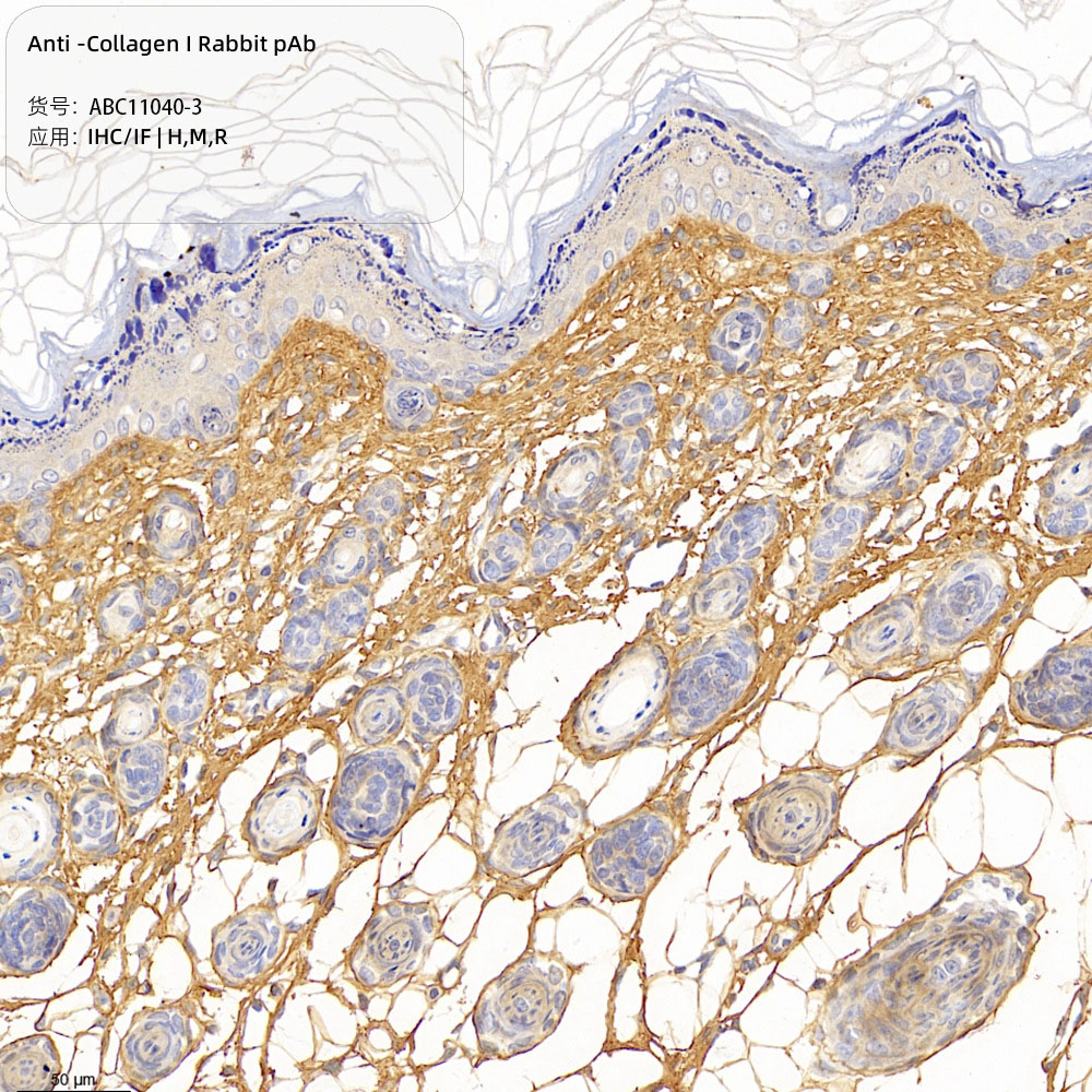 Anti -Collagen I Rabbit pAb （ABC11040-3）