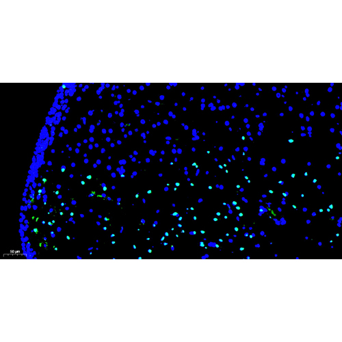 Fluorescein (FITC) Tunel Cell Apoptosis Detection Kit 100T （ABC1519）