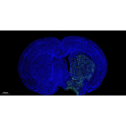 CF488 Tunel Cell Apoptosis Detection Kit 100T （ABC1522）