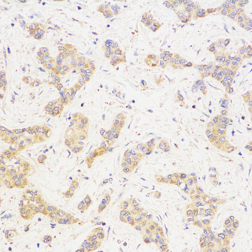 Anti -GAPDH Mouse mAb （ABC12020）