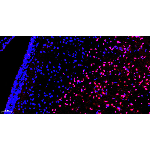 TMR (red) Tunel Cell Apoptosis Detection Kit 50T （ABC1520）