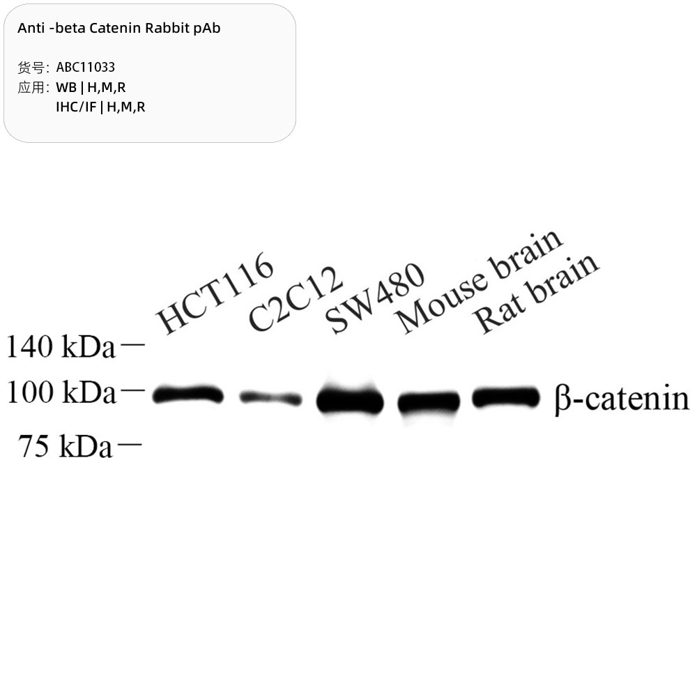 Anti -beta Catenin Rabbit pAb （ABC11033）