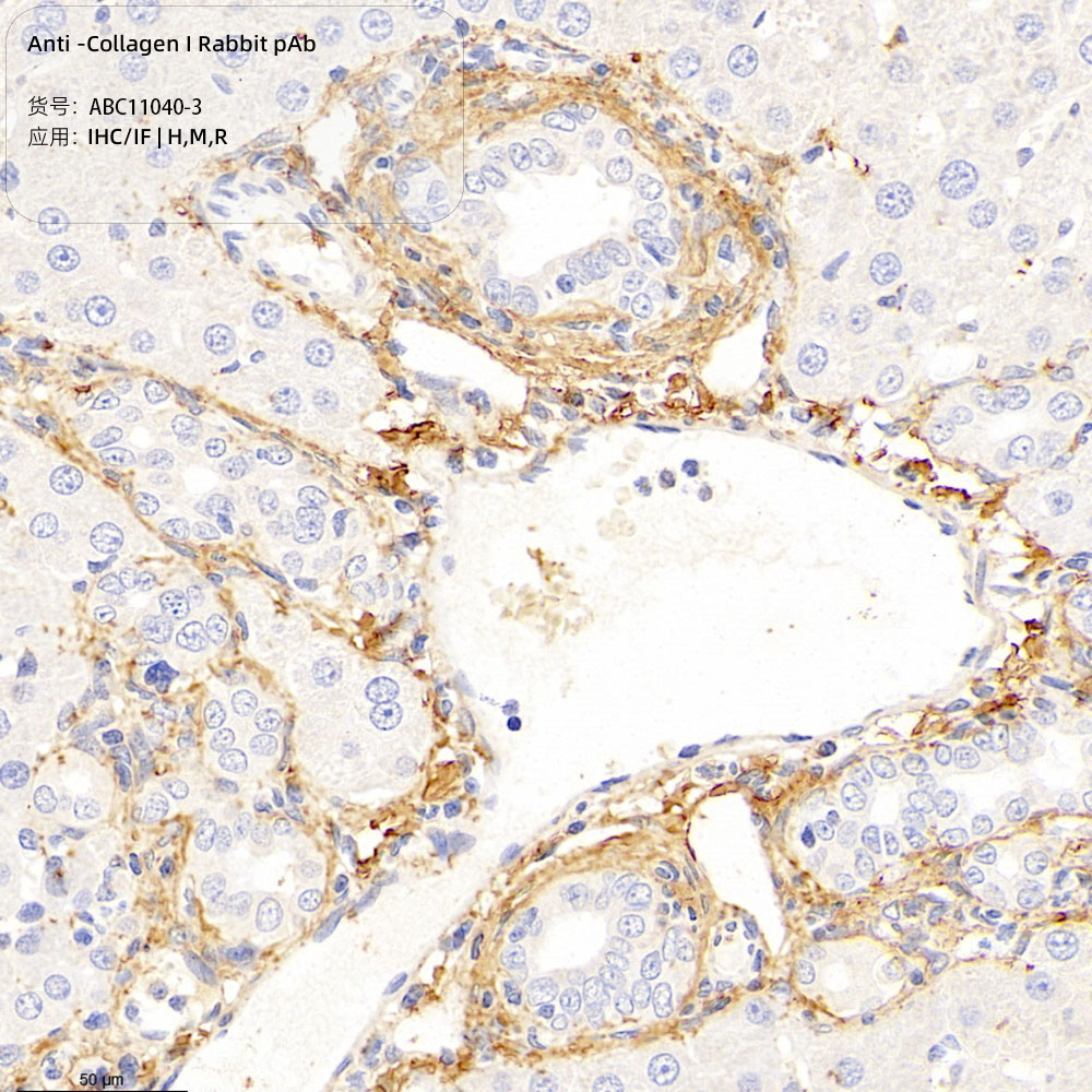 Anti -Collagen I Rabbit pAb （ABC11040-3）