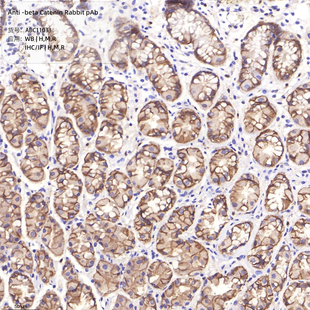 Anti -beta Catenin Rabbit pAb （ABC11033）