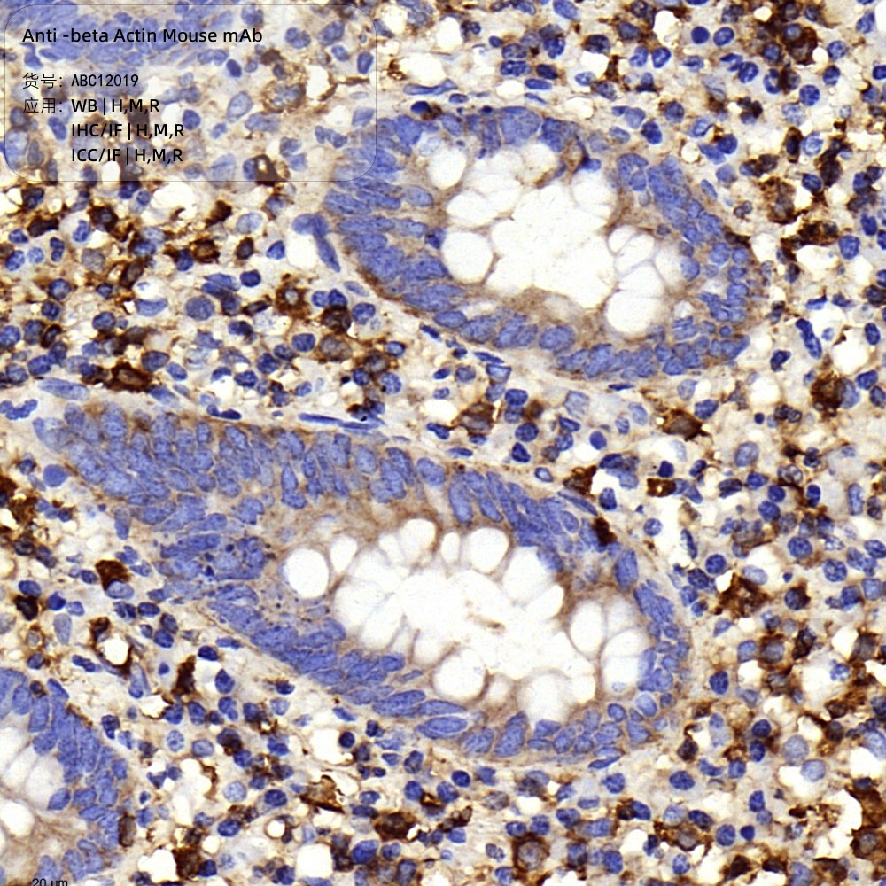 Anti -beta Actin Mouse mAb （ABC12019）