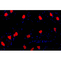 Anti -Slow Skeletal Myosin Heavy chain Rabbit pAb （ABC111875）