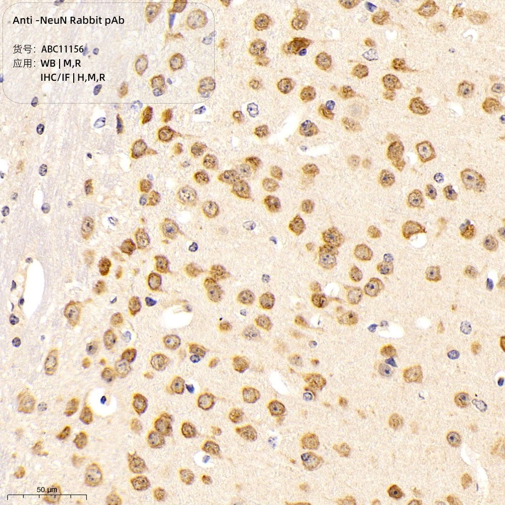 Anti -NeuN Rabbit pAb （ABC11156）