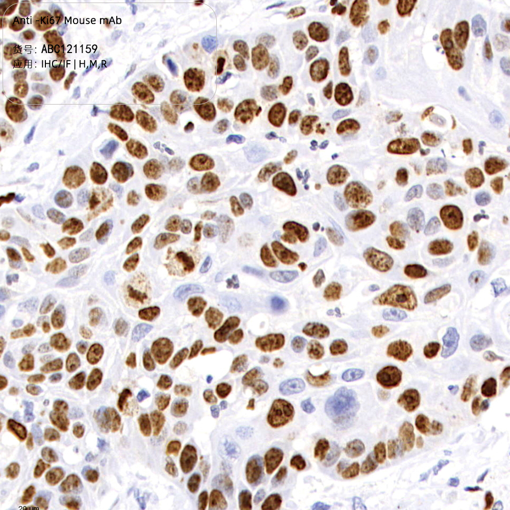 Anti -Ki67 Mouse mAb （ABC121159）