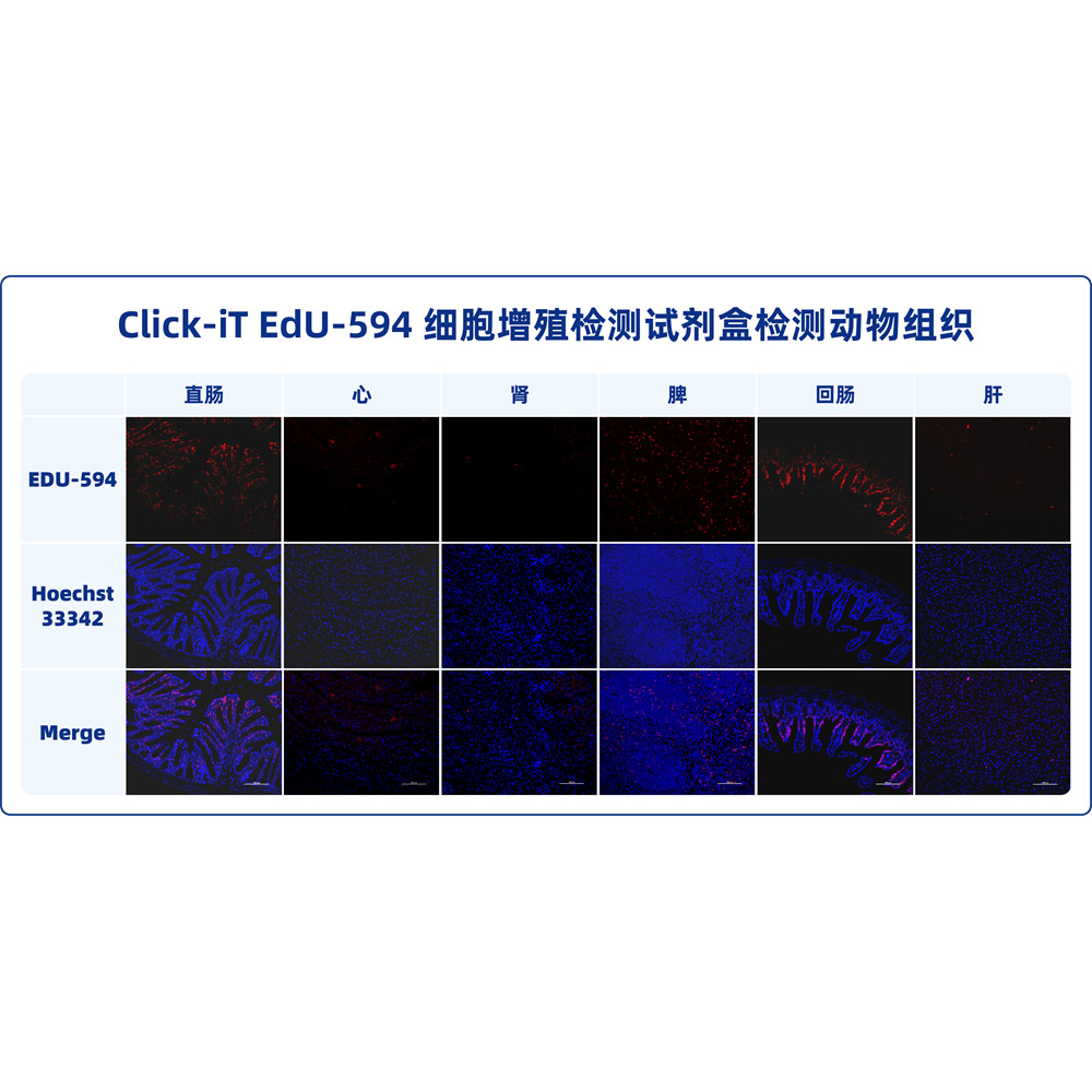 Click-iT EdU-594細(xì)胞增殖檢測(cè)試劑盒 （ABC1621）