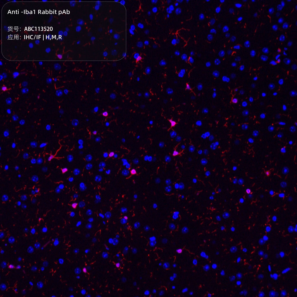 Anti -Iba1 Rabbit pAb （ABC113520）