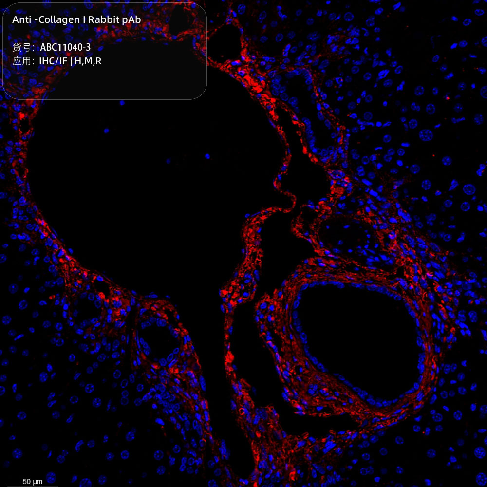 Anti -Collagen I Rabbit pAb （ABC11040-3）