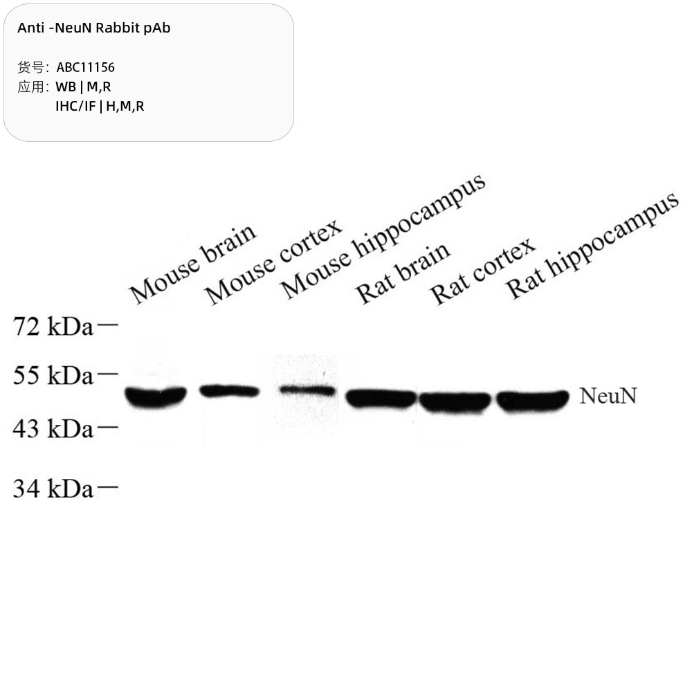 Anti -NeuN Rabbit pAb （ABC11156）