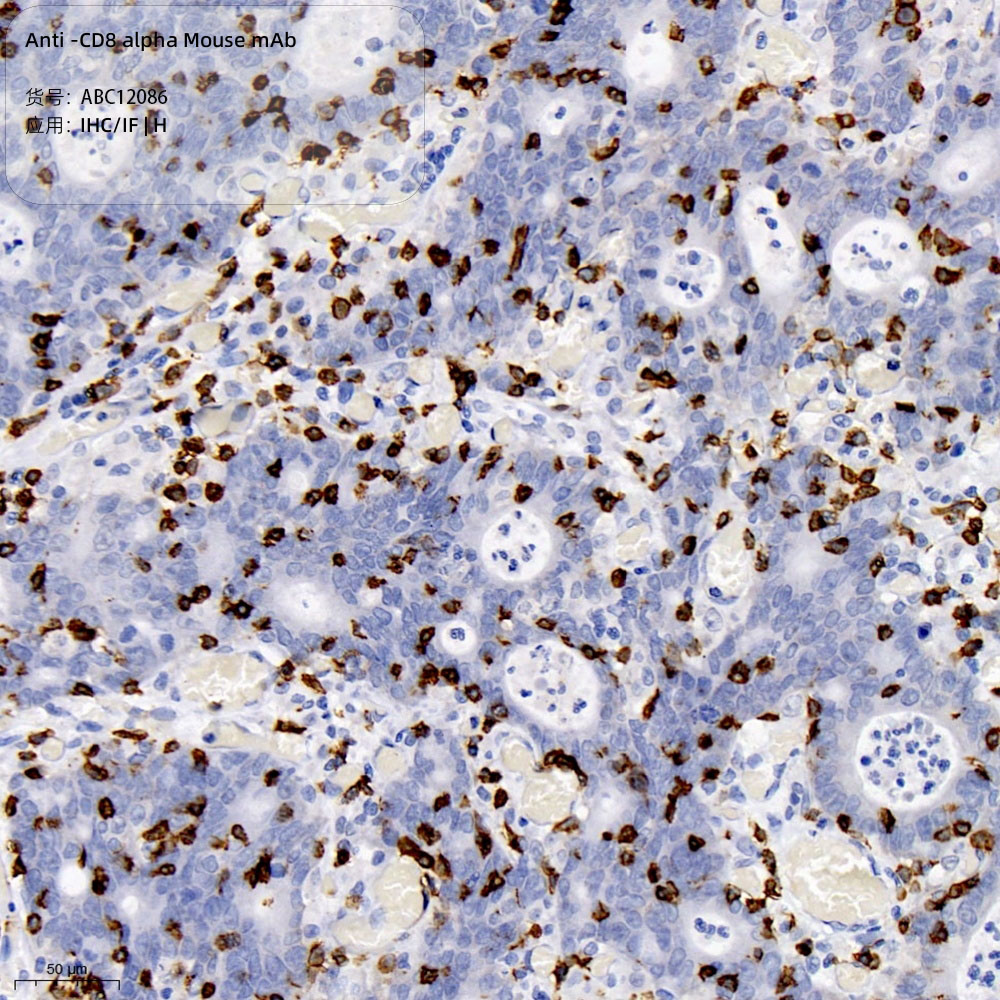 Anti -CD8 alpha Mouse mAb （ABC12086）