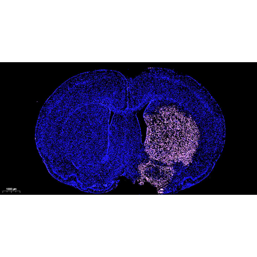 CF640 Tunel Cell Apoptosis Detection Kit 100T （ABC1523）