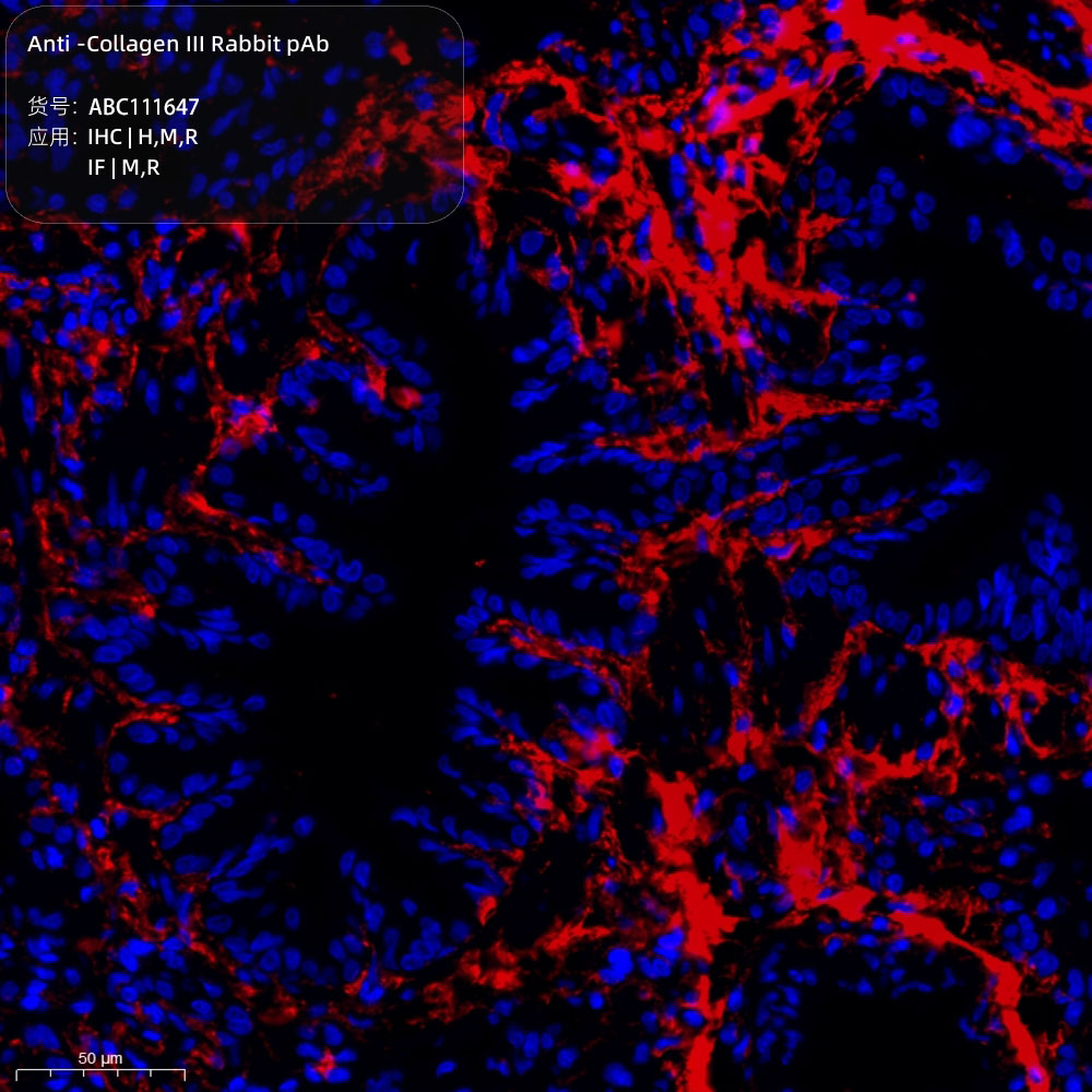 Anti -Collagen III Rabbit pAb （ABC111647）