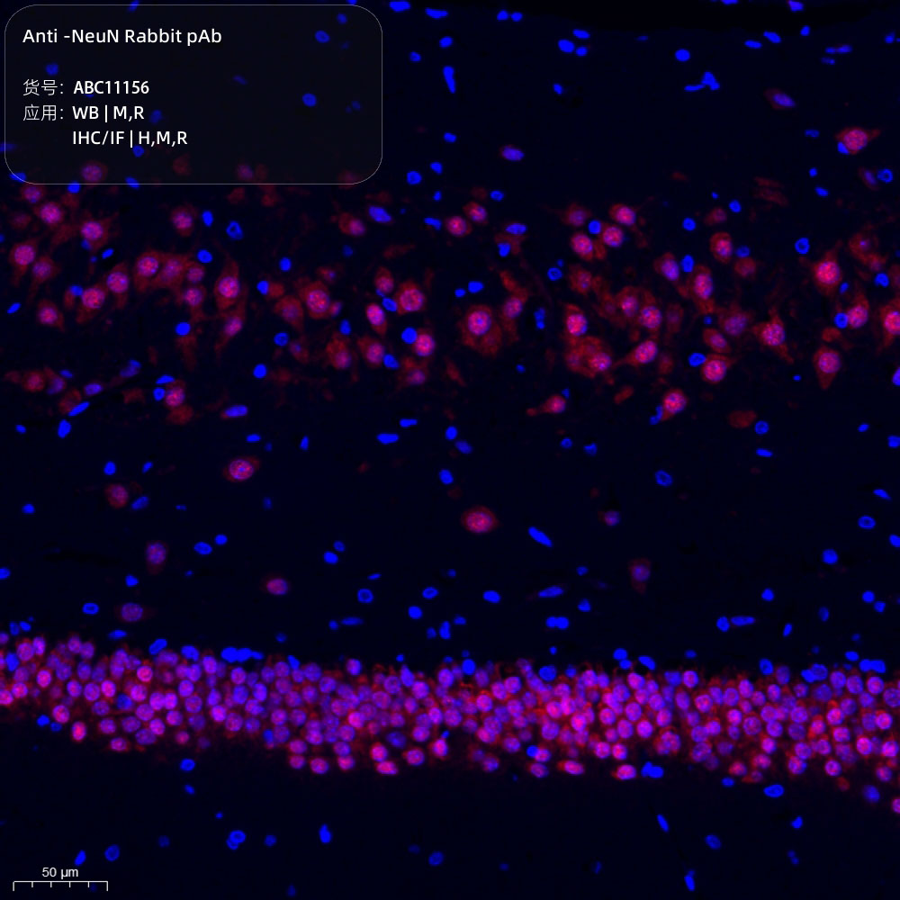 Anti -NeuN Rabbit pAb （ABC11156）