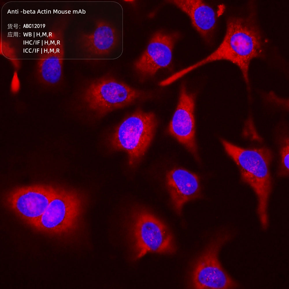 Anti -beta Actin Mouse mAb （ABC12019）