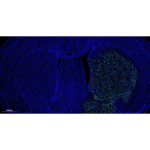 CF488 Tunel Cell Apoptosis Detection Kit 100T （ABC1522）