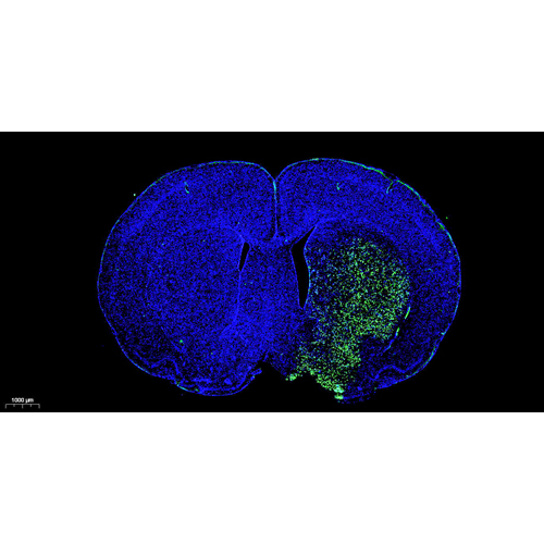 Fluorescein (FITC) Tunel Cell Apoptosis Detection Kit 100T （ABC1519）