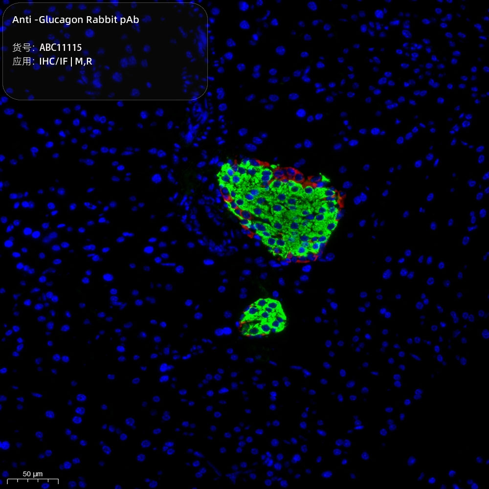 Anti -Glucagon Rabbit pAb （ABC11115）