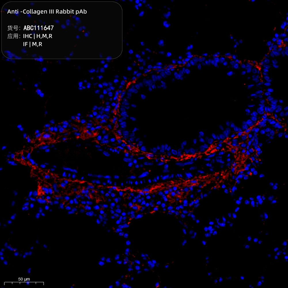 Anti -Collagen III Rabbit pAb （ABC111647）