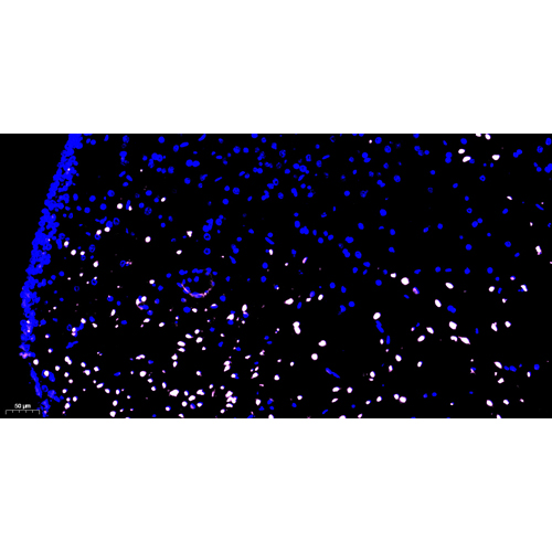 CF640 Tunel Cell Apoptosis Detection Kit 100T （ABC1523）