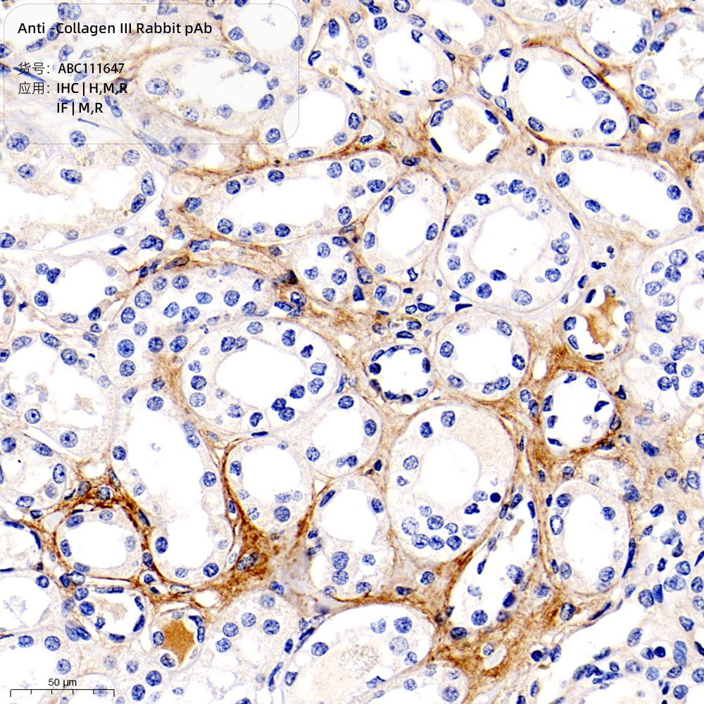 Anti -Collagen III Rabbit pAb （ABC111647）