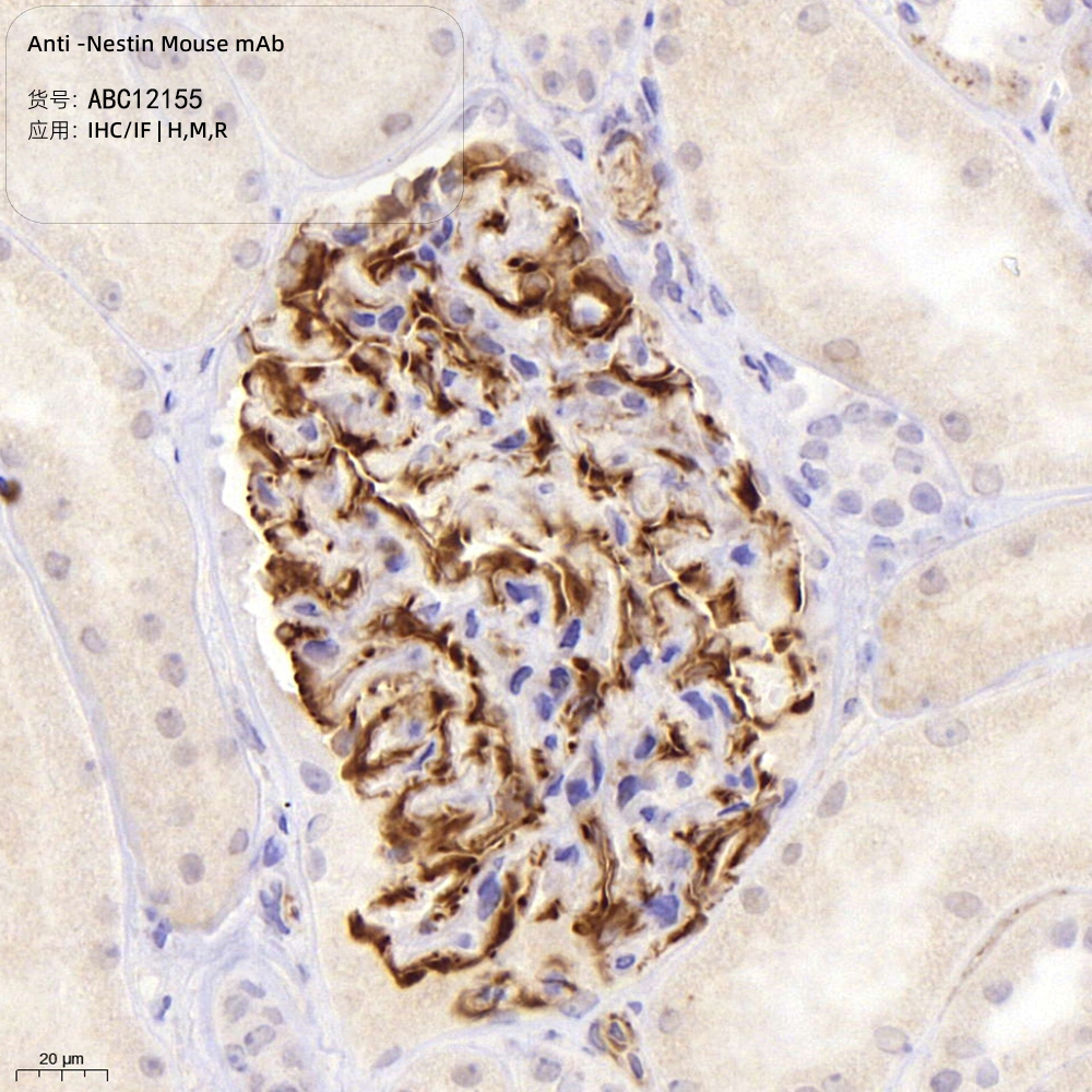 Anti -Nestin Mouse mAb （ABC12155）