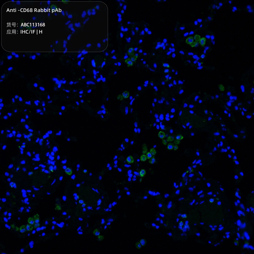 Anti -CD68 Rabbit pAb （ABC113168）