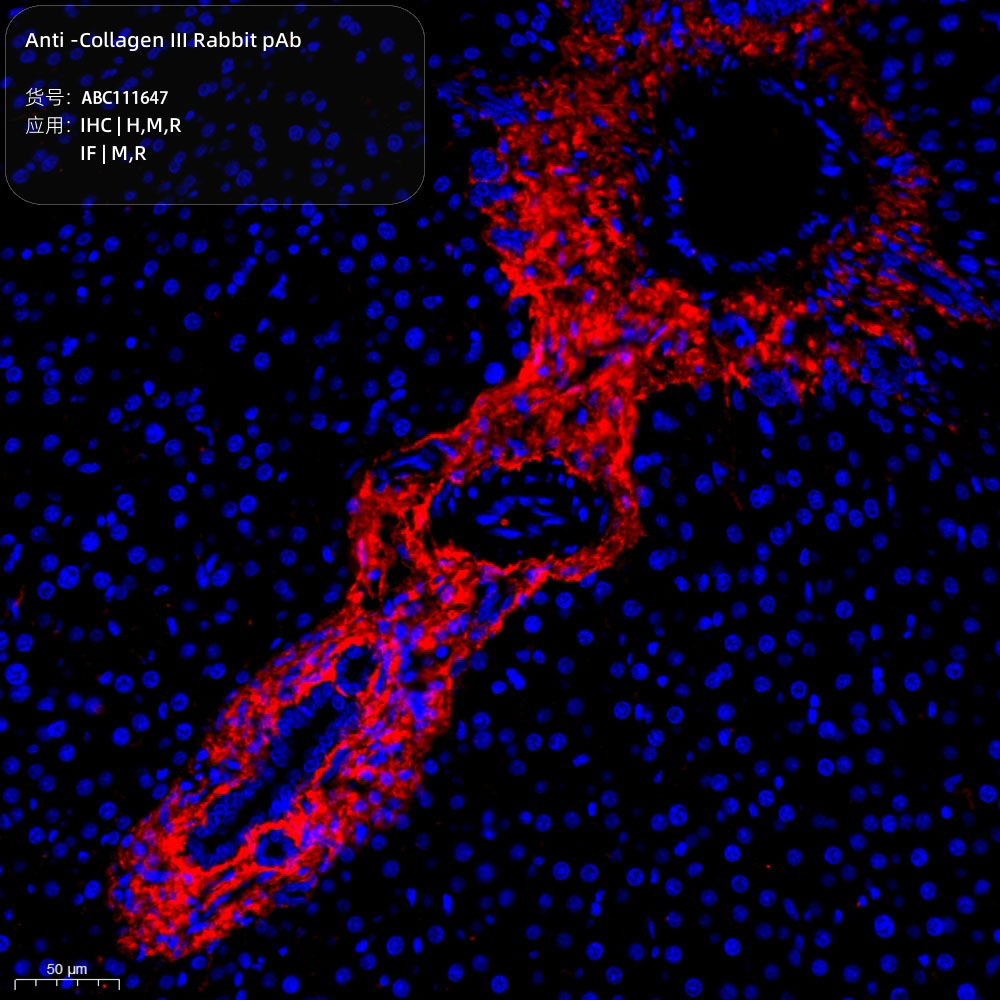 Anti -Collagen III Rabbit pAb （ABC111647）