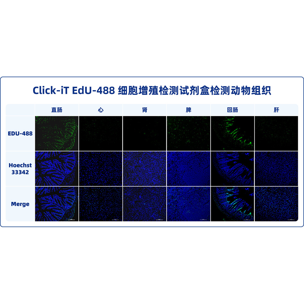 Click-iT EdU-488細(xì)胞增殖檢測(cè)試劑盒 （ABC1619）