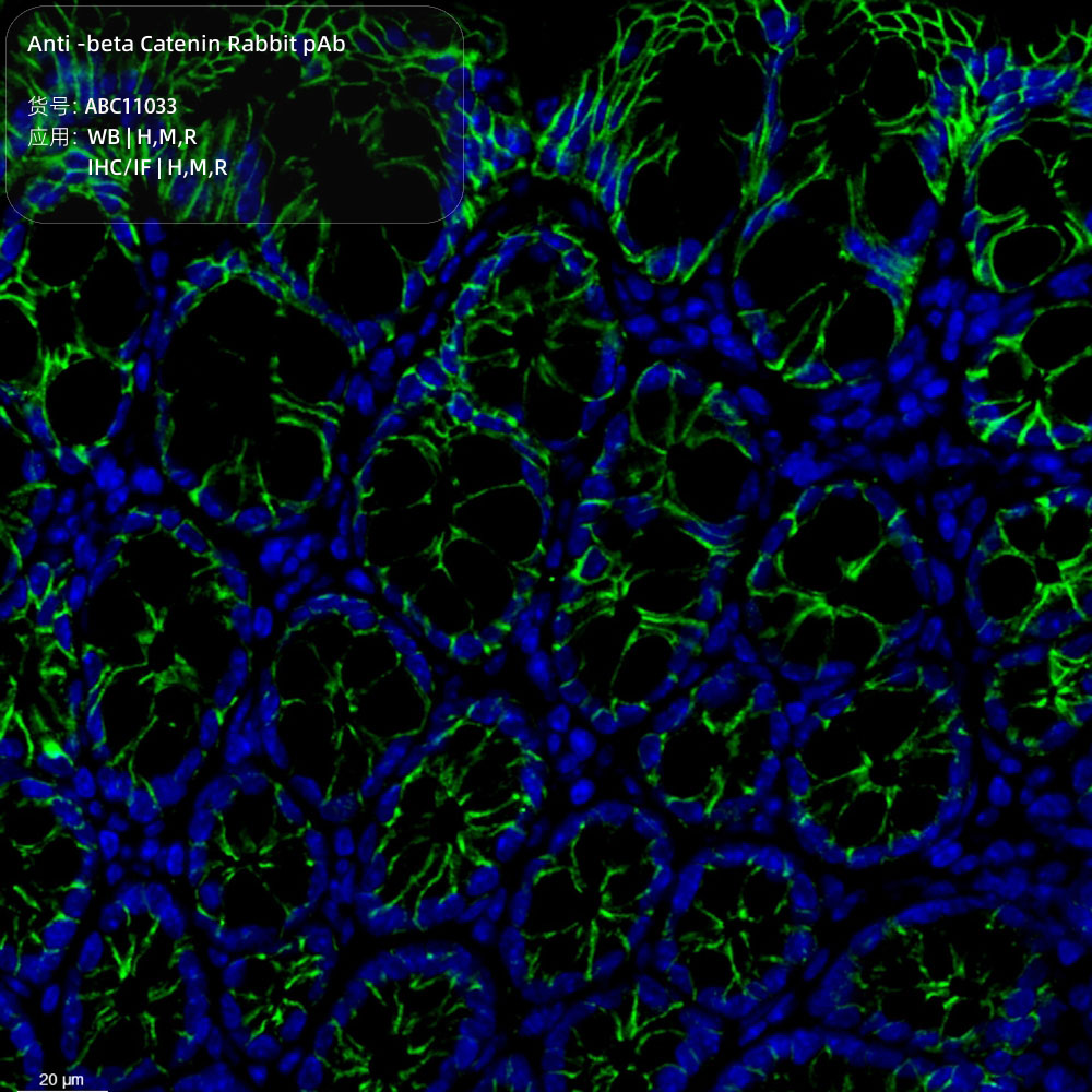 Anti -beta Catenin Rabbit pAb （ABC11033）