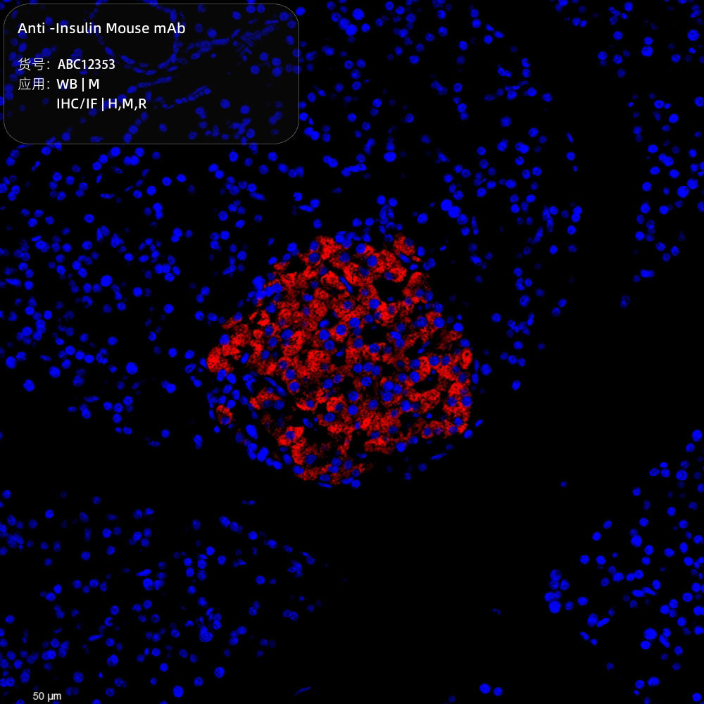 Anti -Insulin Mouse mAb （ABC12353）