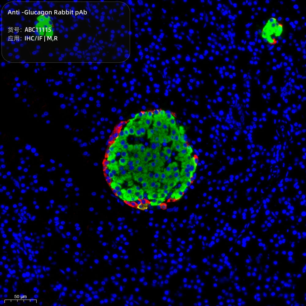 Anti -Glucagon Rabbit pAb （ABC11115）