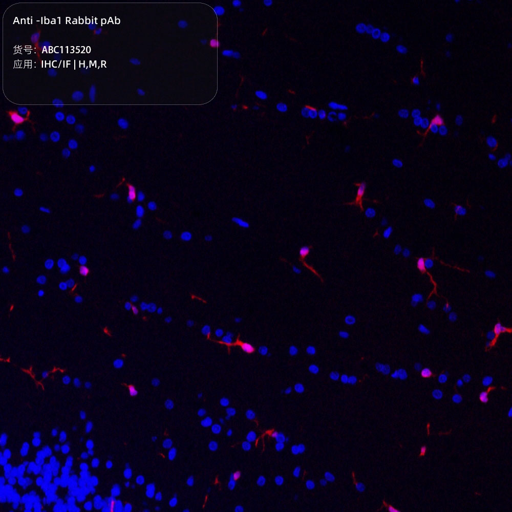 Anti -Iba1 Rabbit pAb （ABC113520）