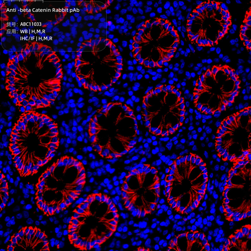 Anti -beta Catenin Rabbit pAb （ABC11033）