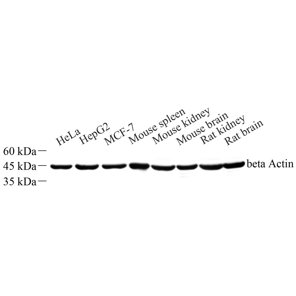 Anti -beta Actin Mouse mAb （ABC12019）