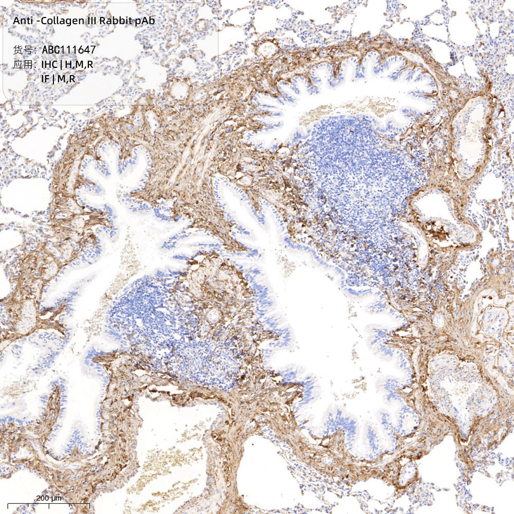 Anti -Collagen III Rabbit pAb （ABC111647）